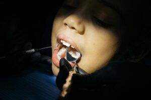 Orthodontist Bloomington IL: Smart Reasons to Start Treatment Early
