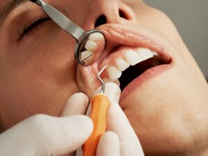 Clear Braces Bloomington IL for Safe and Reliable Treatment
