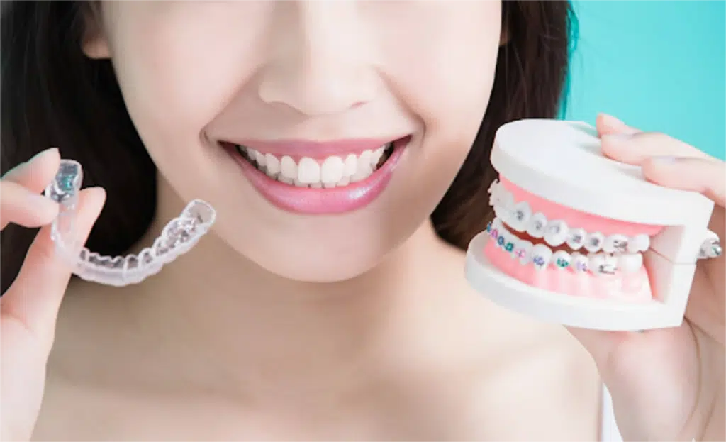 Invisalign vs Braces