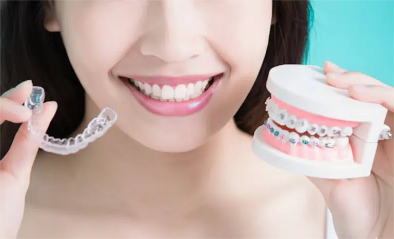 Invisalign vs Braces