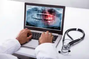 Doctor in a white lab coat using a laptop to view a digital panoramic dental X-ray with a red highlighted area