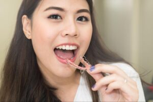 Smiling woman holding a clear and pink orthodontic retainer near her open mouth