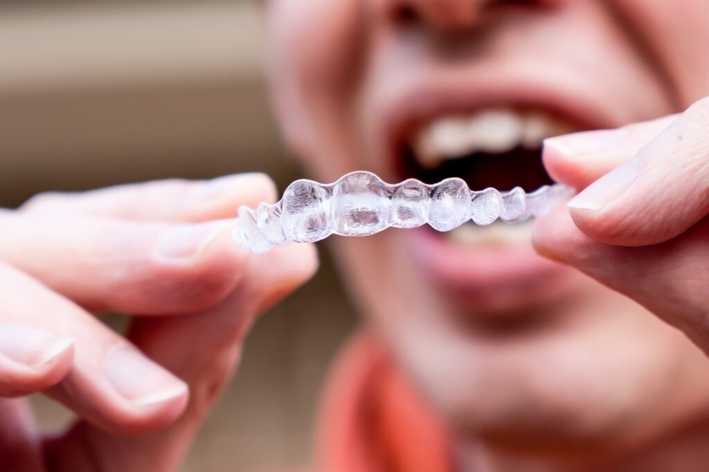 Patient holding a clear aligner near a smile